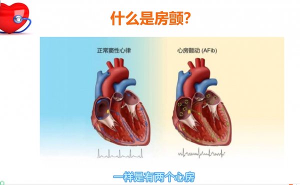 “房”患于未然